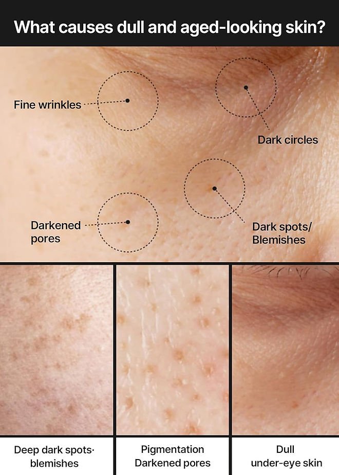 CELIMAX - Pore + Dark Spot Brightening Cream